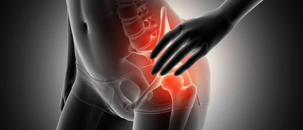 ondas de choque trocanteritis