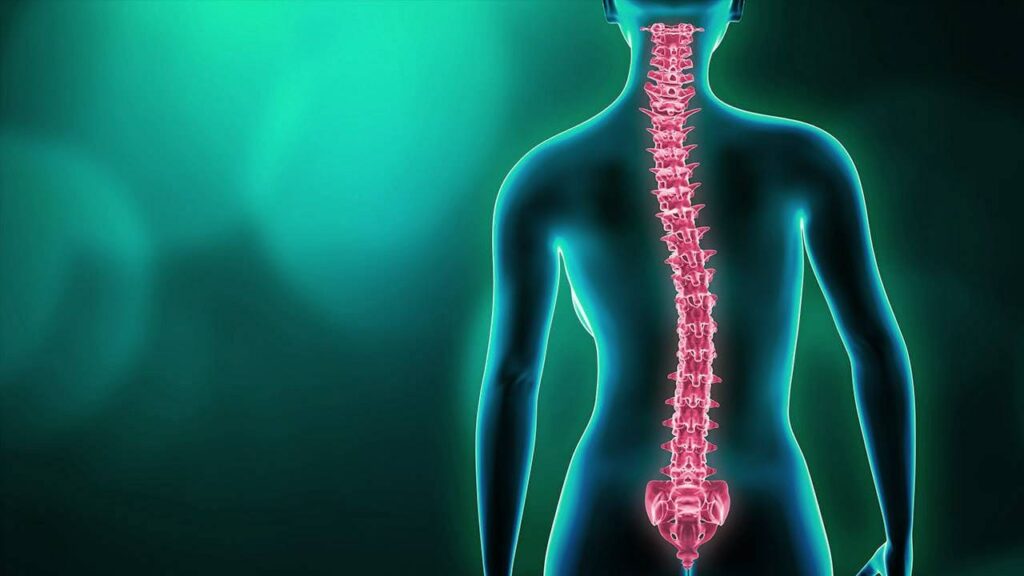 escoliosis