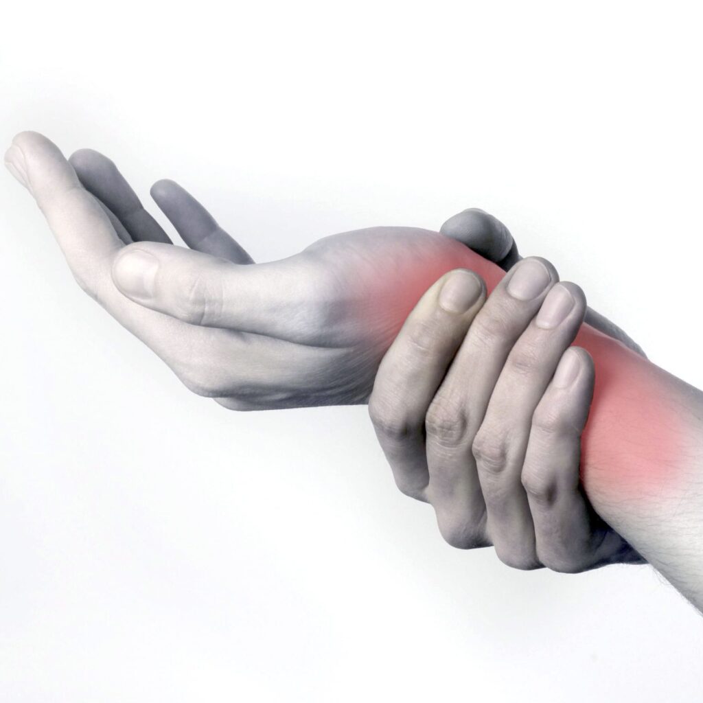 tendinitis de muñeca