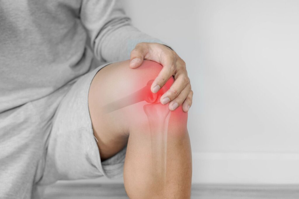 luxación de rodilla