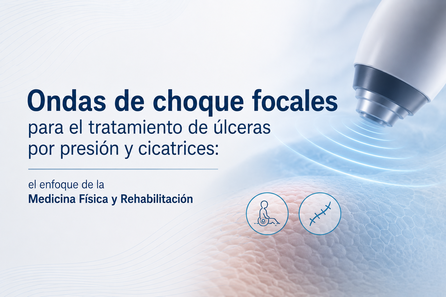 ondas de choque focales