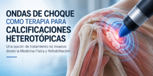 Ondas de choque como terapia para calcificaciones heterotópicas